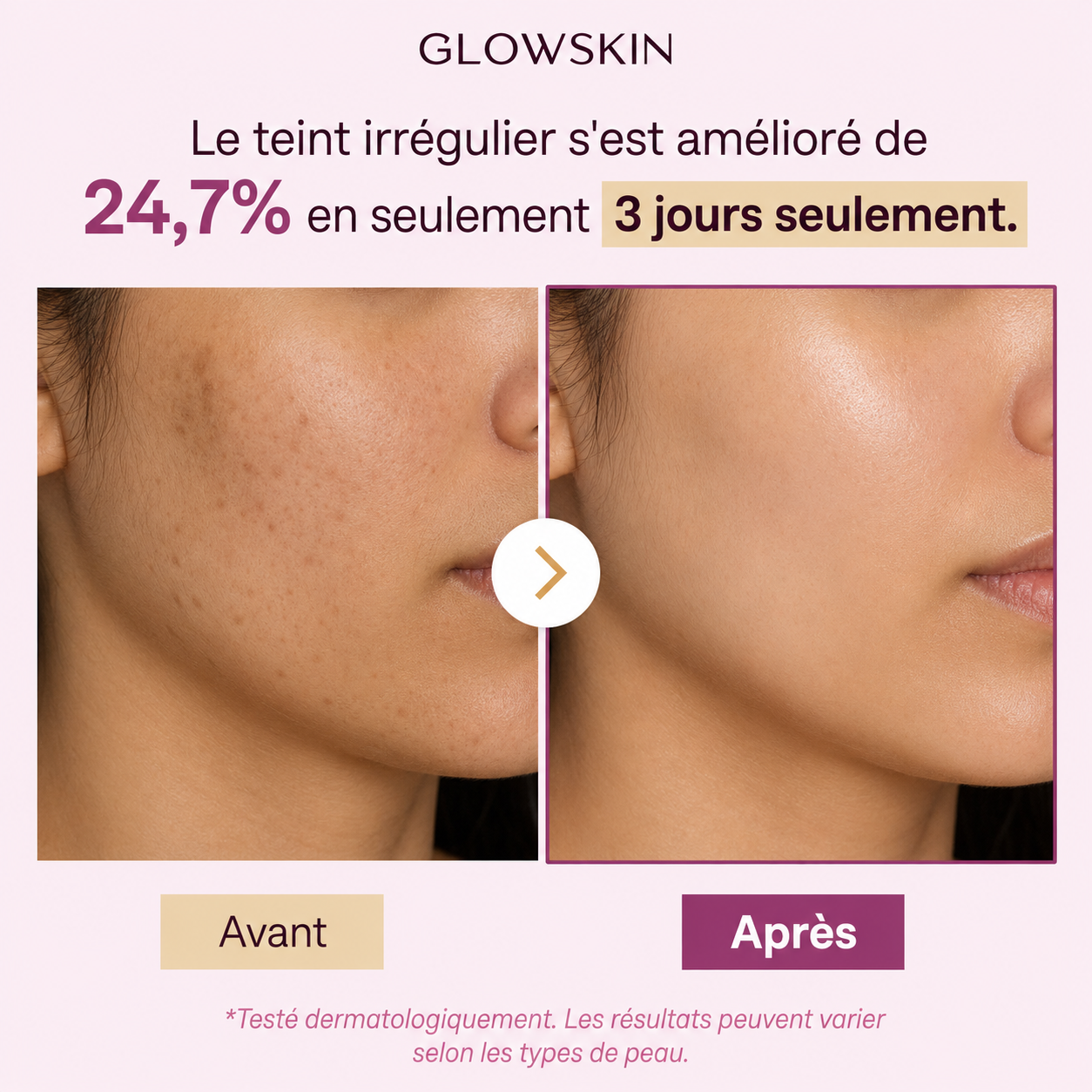 GLOWSKIN Night Mask — Anti-Taches & Hyperpigmentation