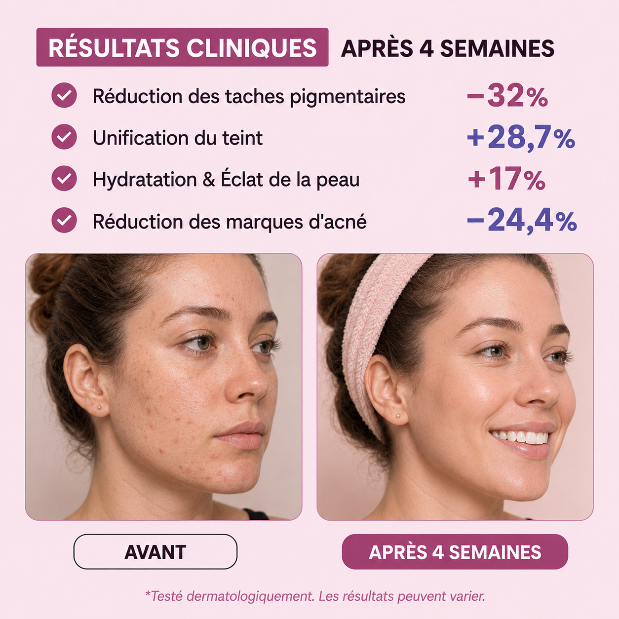 GLOWSKIN Ritual — La Gamme complète Anti-Taches & Hyperpigmentation