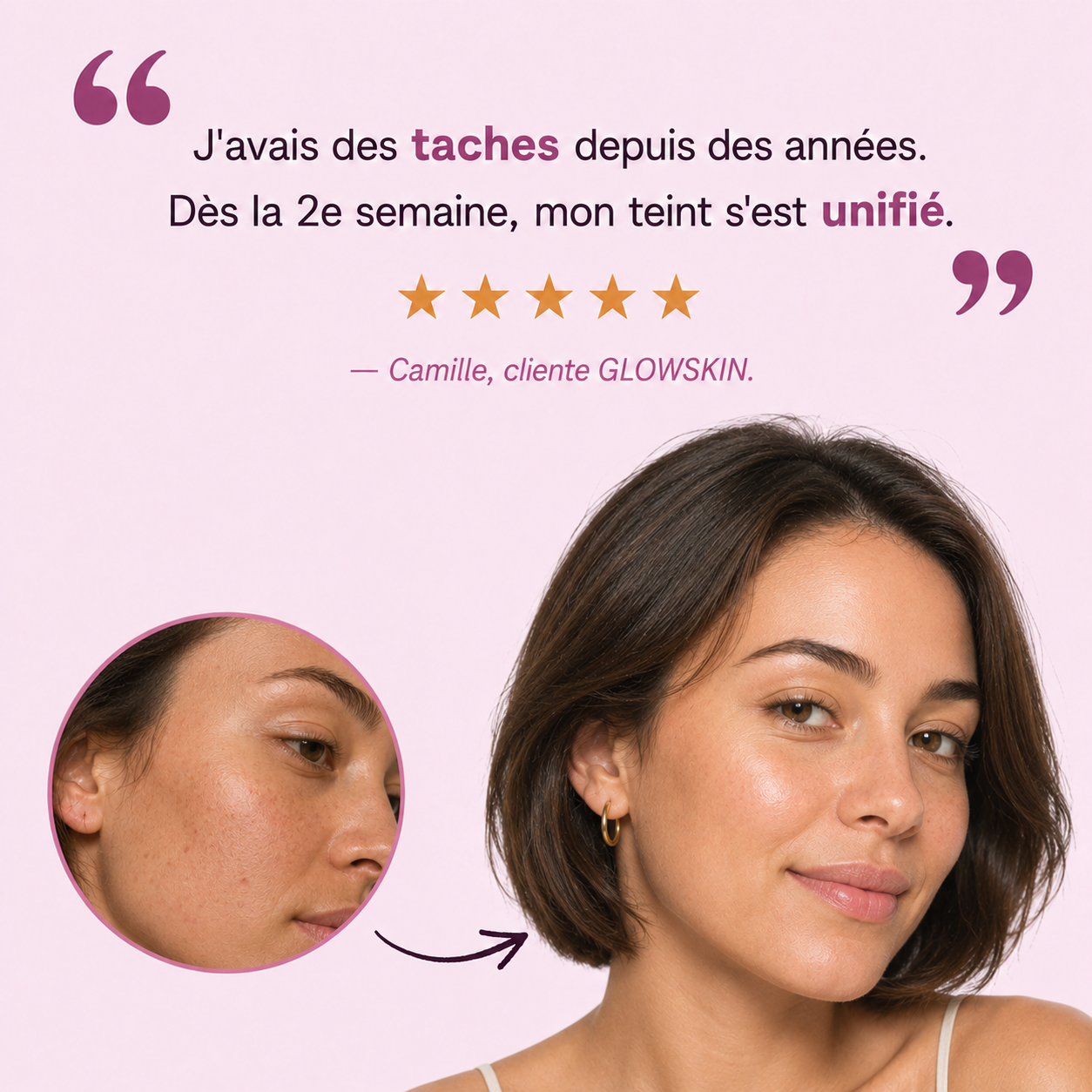 GLOWSKIN Ritual — La Gamme complète Anti-Taches & Hyperpigmentation